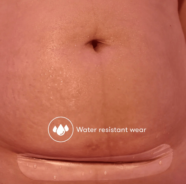 C-Section Silicone Scar Patches | FridaMom-C-Section Supplies-Birth Supplies Canada