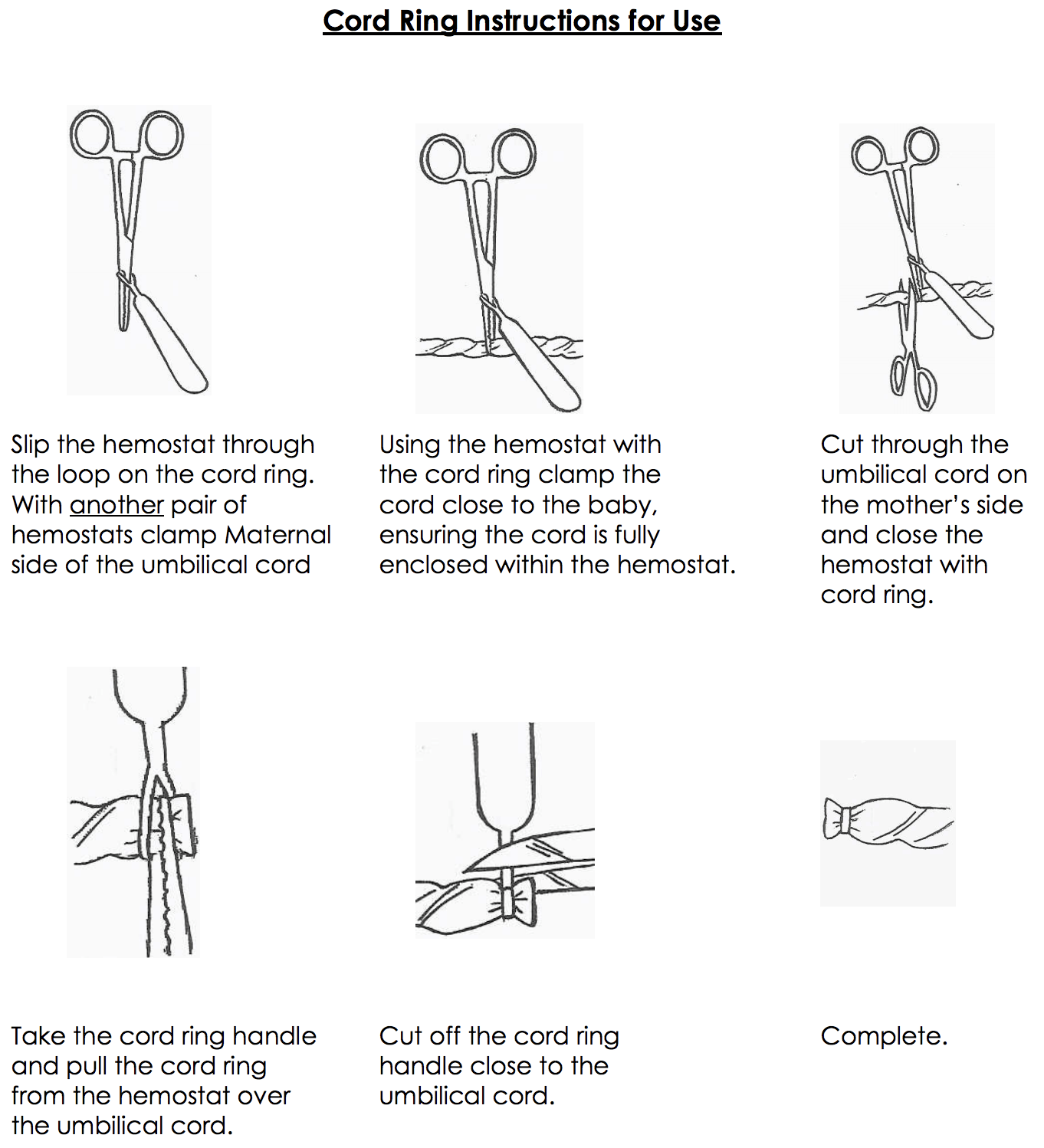 CETRO Cord Rings-IMPORT-DEVICE-Birth Supplies Canada