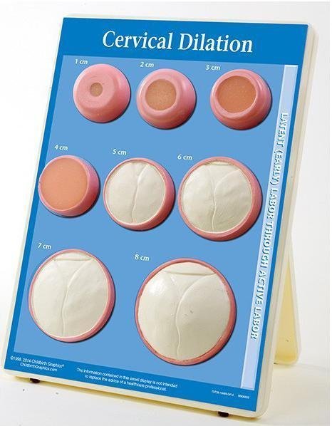 Cervical Dilation Model | Stages of Labor Visual Aid-Teaching Aids-Birth Supplies Canada