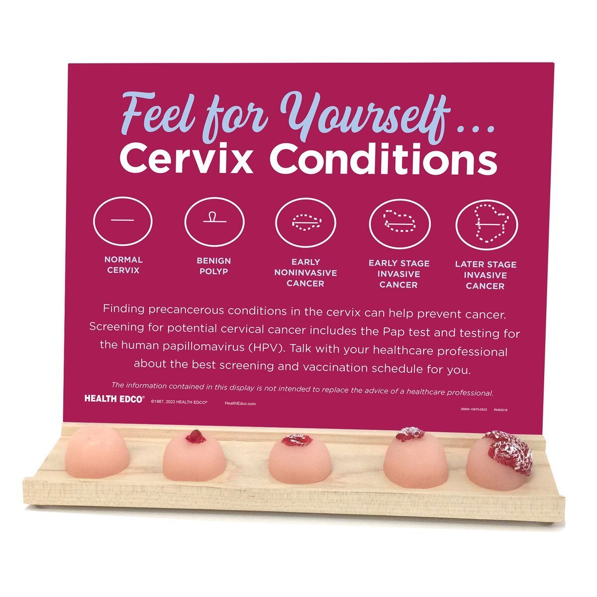 Feel for Yourself: Cervix Conditions Display | Healthcare Training Model - Buy Medical Supplies Online Canada