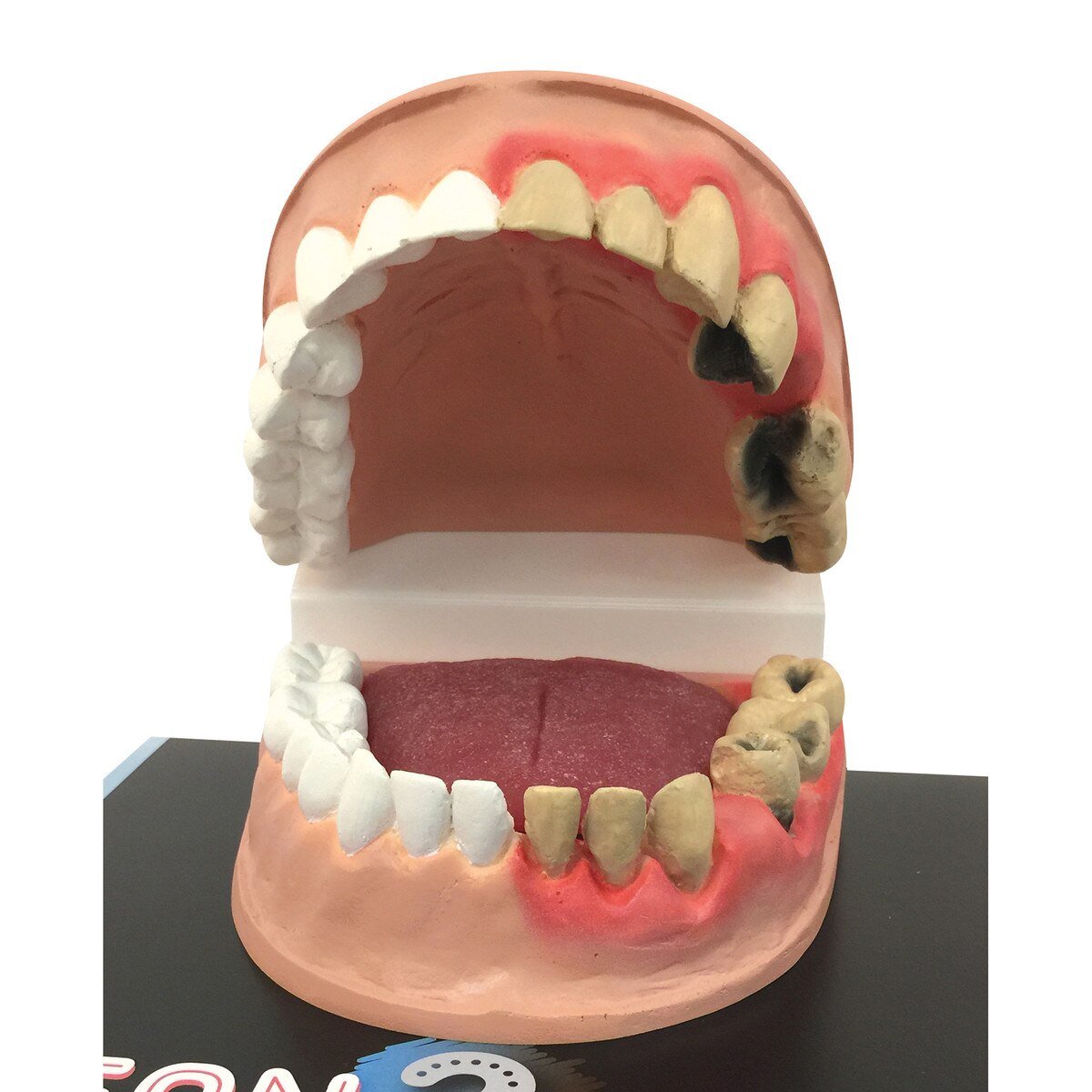 Clean Mouth / Dirty Mouth Display-Teaching Aids-Birth Supplies Canada