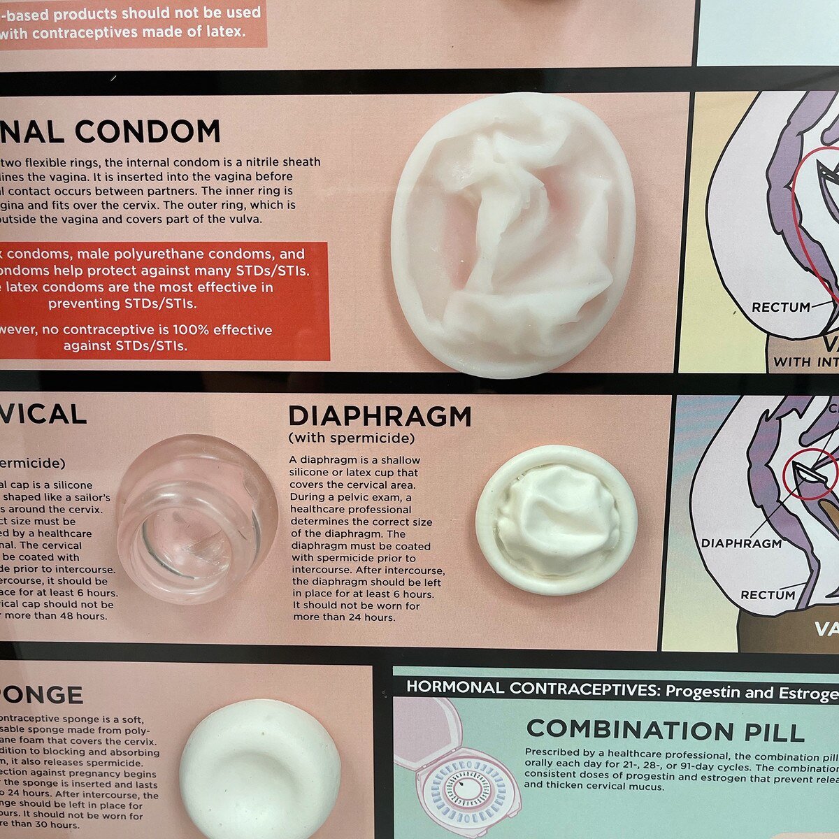 Comprehensive Contraceptive Methods 3-D Model Educational Kit-Teaching Aids-Birth Supplies Canada