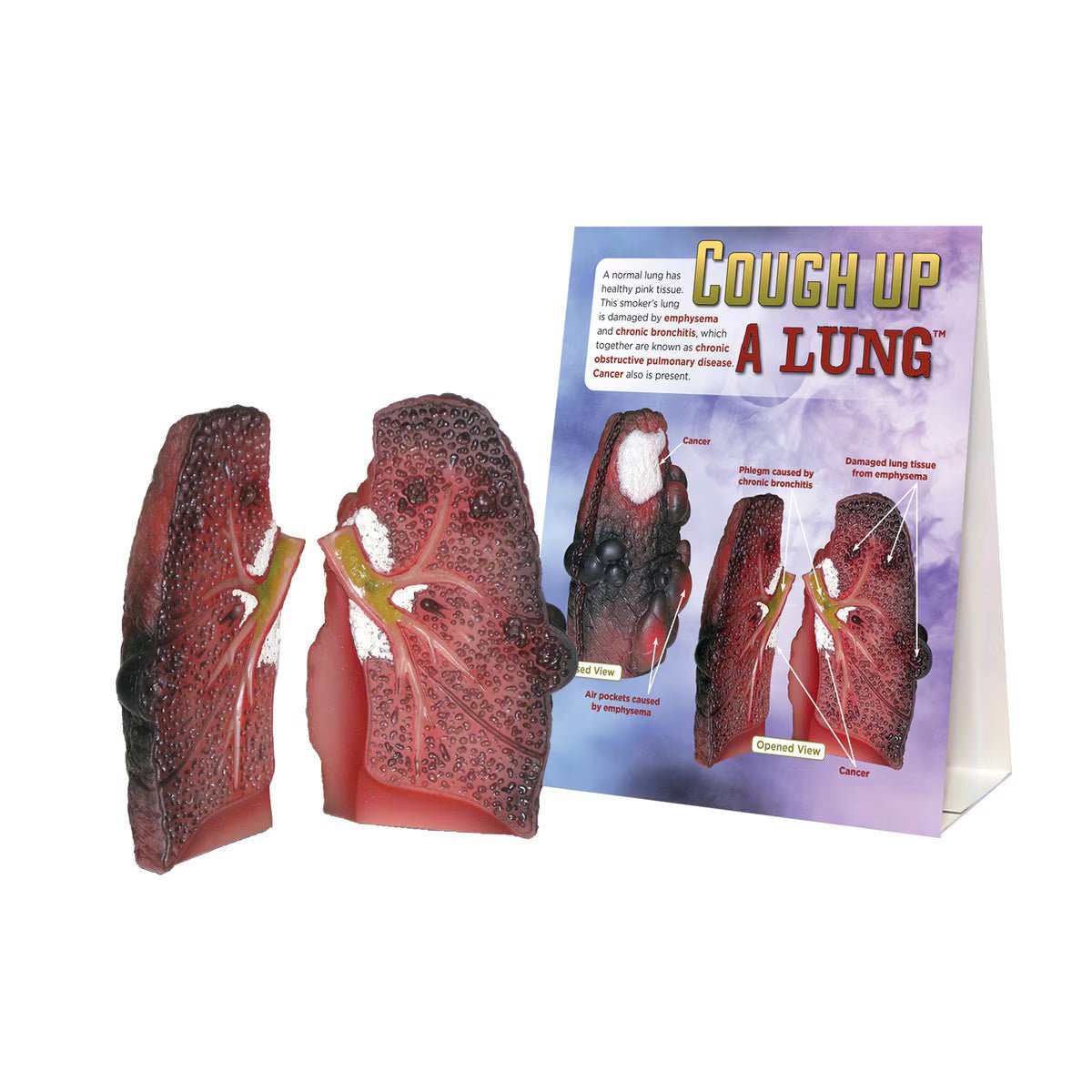 Cough Up A Lung Model - Buy Medical Supplies Online Canada