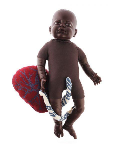 Fetal Doll with Umbilical Cord & Placenta | Clinical Training Model - Buy Medical Supplies Online Canada