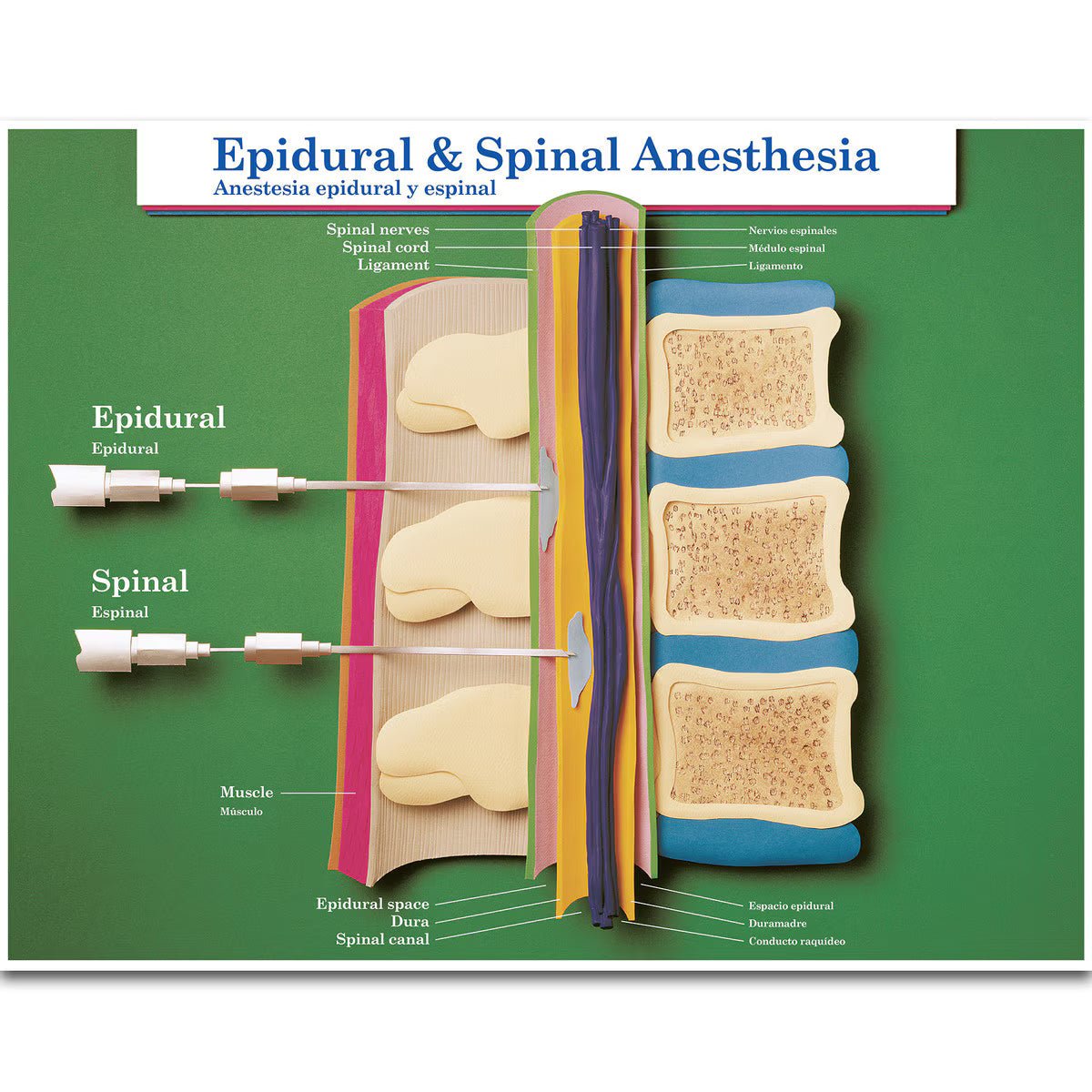 Labour & Birth Intervention Chart Set – Bilingual English/Spanish - Buy Medical Supplies Online Canada