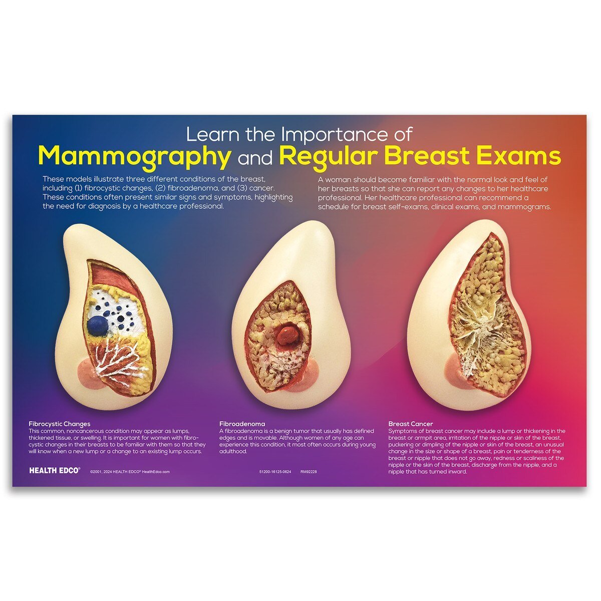 Learn the Importance of Mammography Display | Healthcare Training Model - Buy Medical Supplies Online Canada