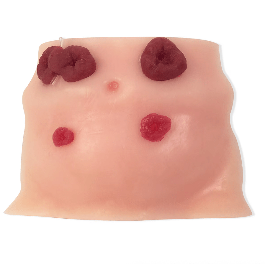 Ostomy Care | Healthcare Training Model - Buy Medical Supplies Online Canada