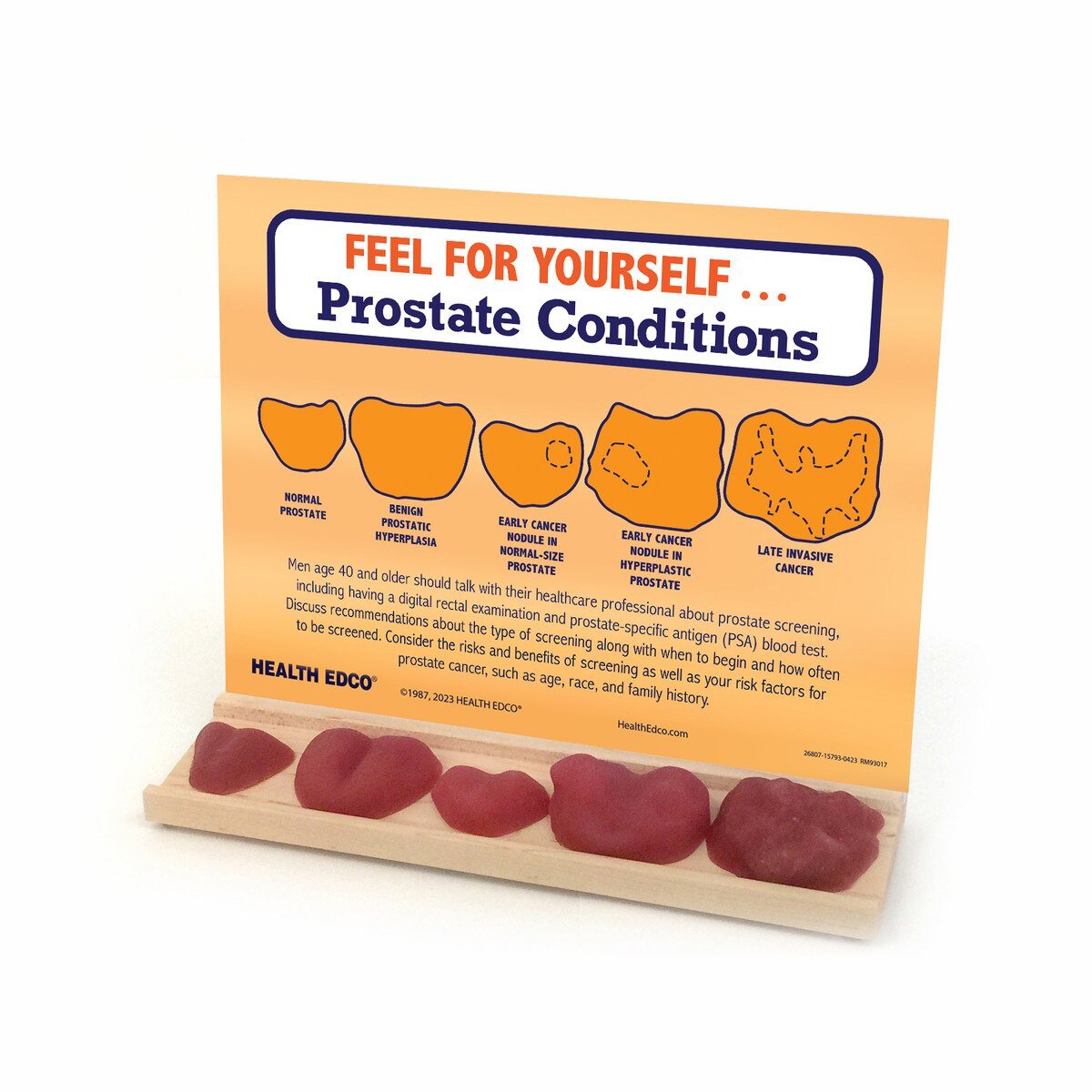 Prostate Conditions Education and Palpation Model Display-Teaching Aids-Birth Supplies Canada