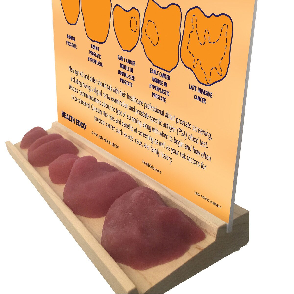 Prostate Conditions Education and Palpation Model Display-Teaching Aids-Birth Supplies Canada