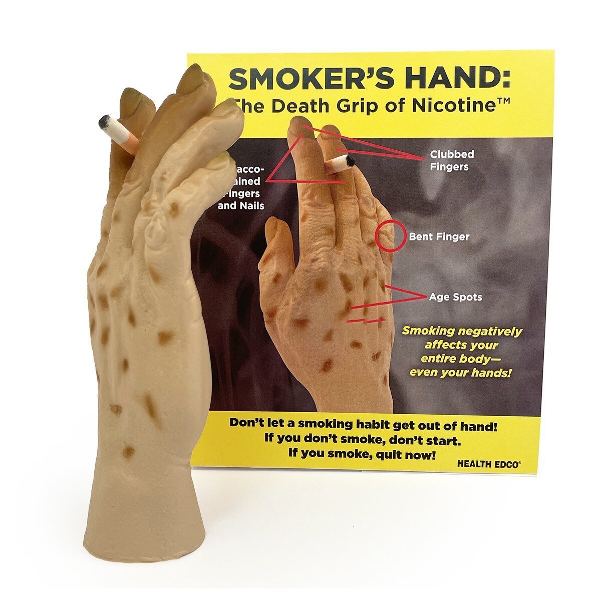 Smoker’s Hand: The Death Grip of Nicotine™ | Healthcare Training Model - Buy Medical Supplies Online Canada