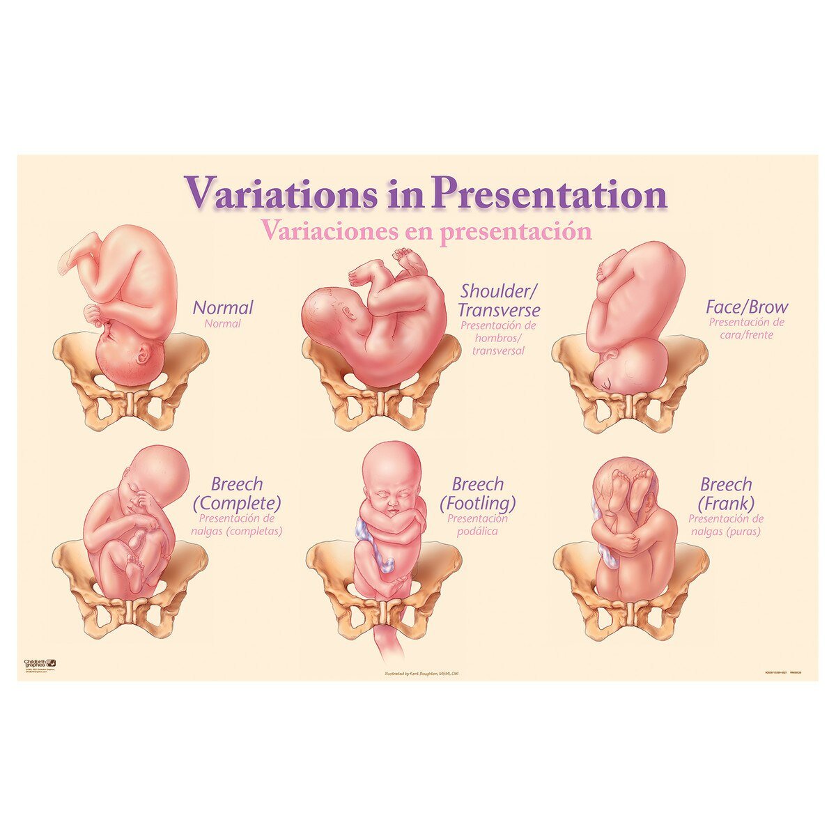 Variations in Presentation Chart | Healthcare Training Model - Buy Medical Supplies Online Canada