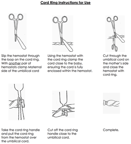 CETRO Cord Rings-Umbilical Cord Needs-Birth Supplies Canada