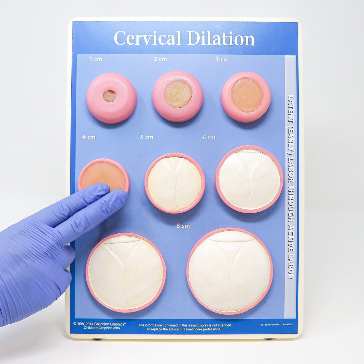 Cervical Dilation Model | Obstetric Training & Education Tool - Buy Medical Supplies Online Canada