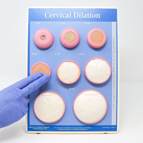 Cervical Dilation Model | Obstetric Training & Education Tool - Buy Medical Supplies Online Canada