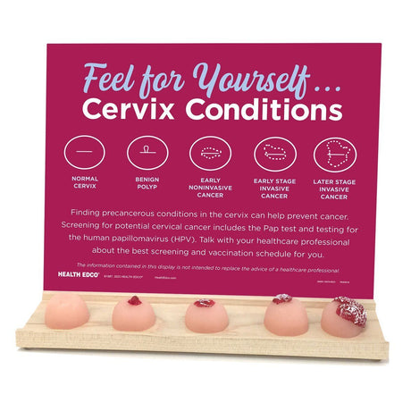 Feel for Yourself: Cervix Conditions Display | Healthcare Training Model - Buy Medical Supplies Online Canada