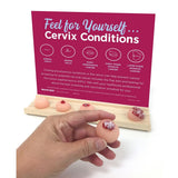 Feel for Yourself: Cervix Conditions Display | Healthcare Training Model - Buy Medical Supplies Online Canada