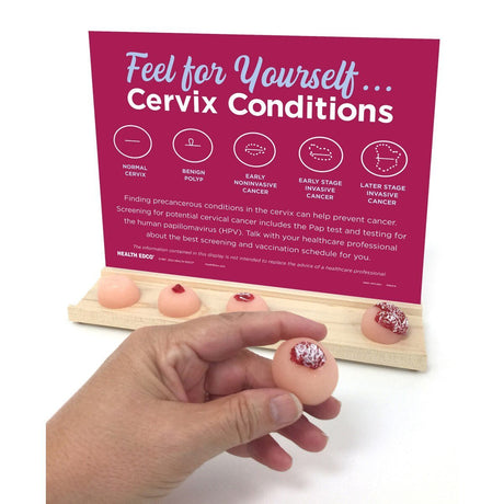 Feel for Yourself: Cervix Conditions Display | Healthcare Training Model - Buy Medical Supplies Online Canada