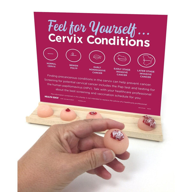 Feel for Yourself: Cervix Conditions Display | Healthcare Training Model - Buy Medical Supplies Online Canada