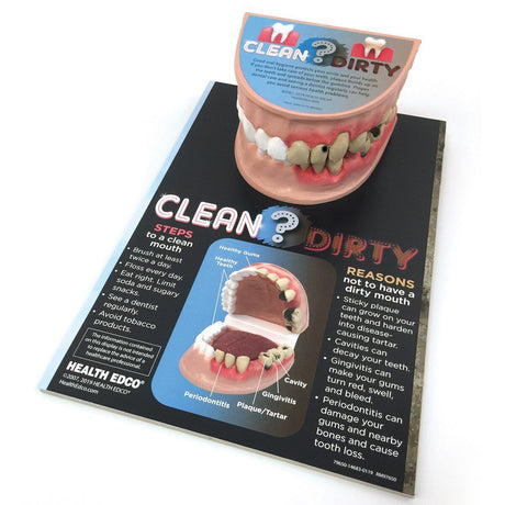 Clean Mouth / Dirty Mouth Display | Healthcare Training Model - Buy Medical Supplies Online Canada