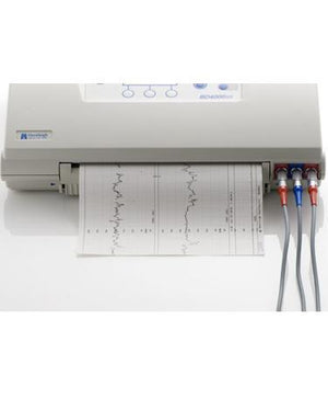 Fetal Monitor ~ Sonicaid BD4000xs-Medical Equipment-Birth Supplies Canada