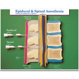 Labour & Birth Intervention Chart Set – Bilingual English/Spanish - Buy Medical Supplies Online Canada