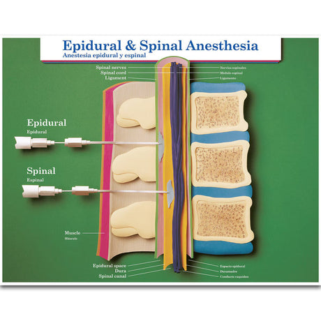Labour & Birth Intervention Chart Set – Bilingual English/Spanish - Buy Medical Supplies Online Canada