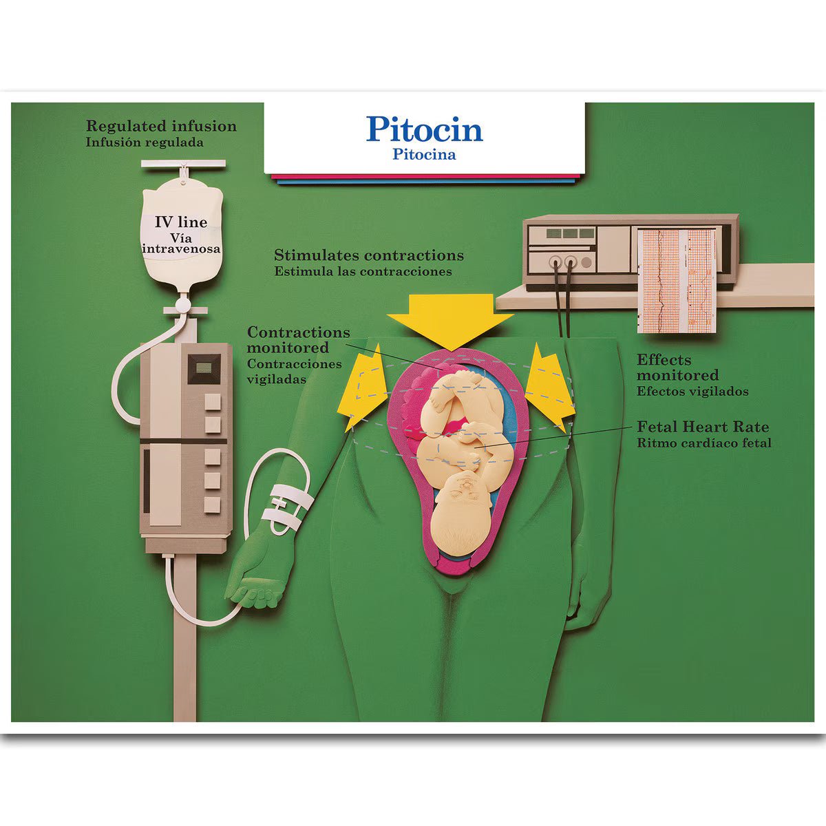 Labour & Birth Intervention Chart Set – Bilingual English/Spanish - Buy Medical Supplies Online Canada