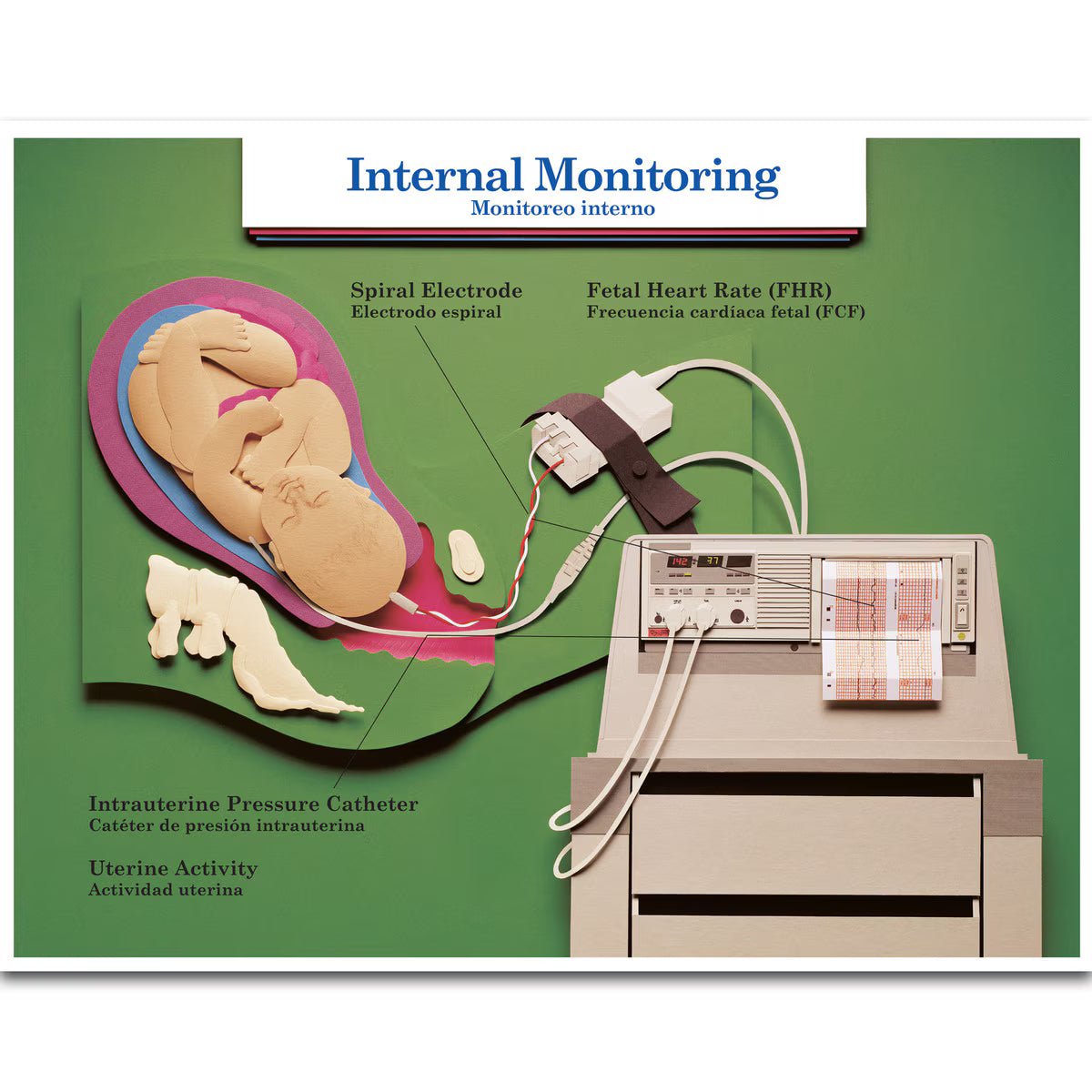 Labour & Birth Intervention Chart Set – Bilingual English/Spanish - Buy Medical Supplies Online Canada