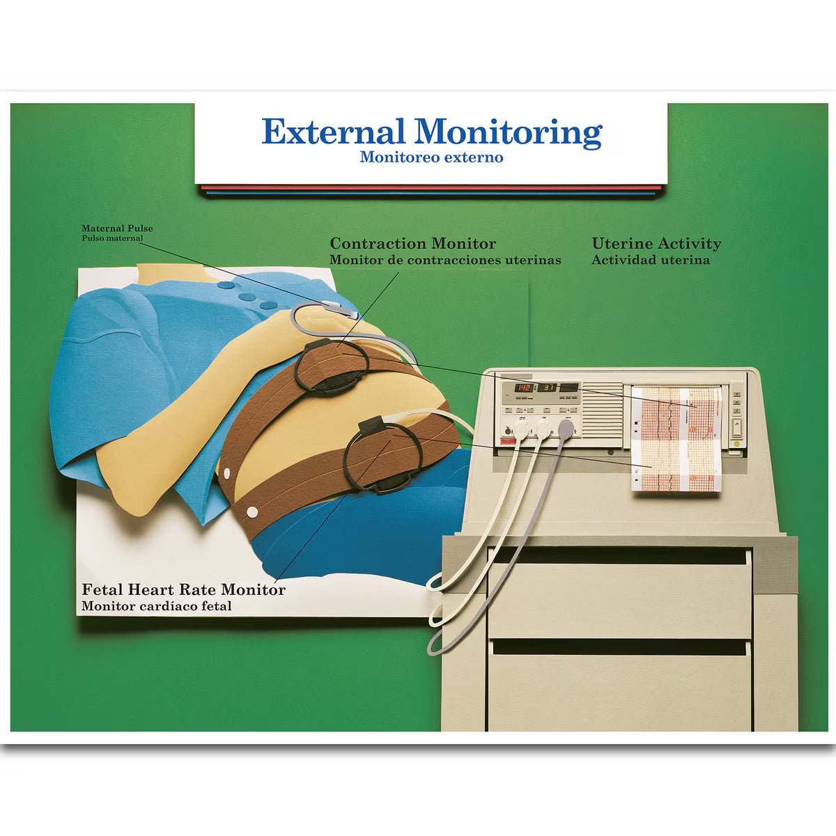Labour & Birth Intervention Chart Set – Bilingual English/Spanish - Buy Medical Supplies Online Canada