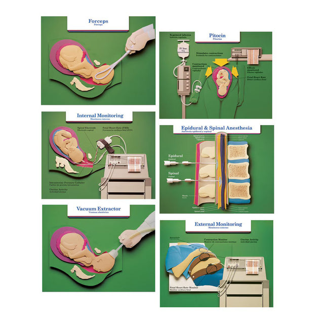 Labour & Birth Intervention Chart Set – Bilingual English/Spanish - Buy Medical Supplies Online Canada