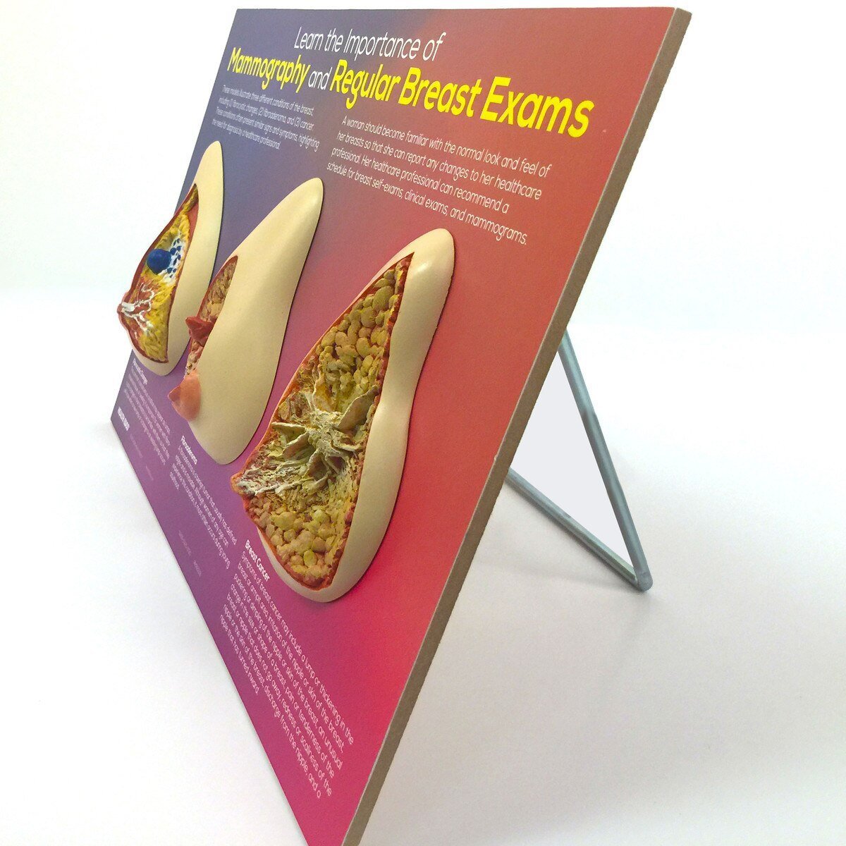 Learn the Importance of Mammography Display | Healthcare Training Model - Buy Medical Supplies Online Canada