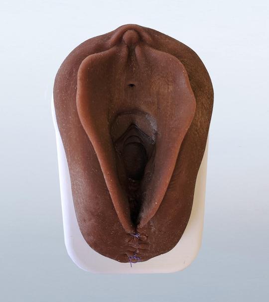 Obstetrics Anal Sphincter Injury Suturing Model-Teaching Aids-Birth Supplies Canada