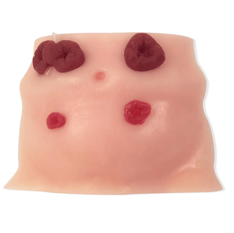 Ostomy Care | Healthcare Training Model - Buy Medical Supplies Online Canada