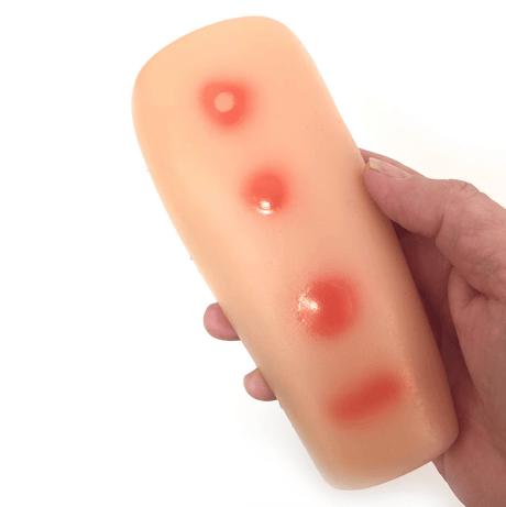 Palpable TB Testing Arm Set | Healthcare Training Model - Buy Medical Supplies Online Canada