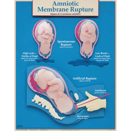 Six Essential Labor and Birth Charts (6), English/Spanish-Teaching Aids-Birth Supplies Canada