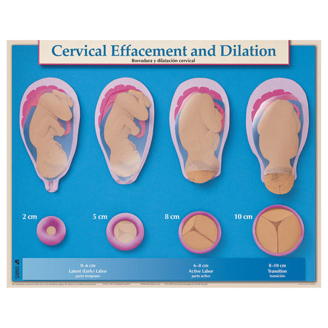 Six Essential Labor and Birth Charts (6), English/Spanish-Teaching Aids-Birth Supplies Canada
