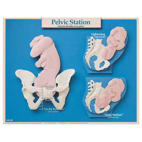 Six Essential Labor and Birth Charts (6), English/Spanish-Teaching Aids-Birth Supplies Canada
