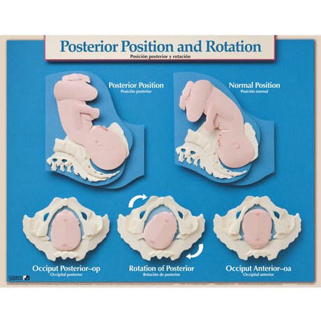 Six Essential Labor and Birth Charts (6), English/Spanish-Teaching Aids-Birth Supplies Canada