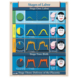 Six Essential Labor and Birth Charts (6), English/Spanish-Teaching Aids-Birth Supplies Canada