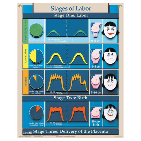Six Essential Labor and Birth Charts (6), English/Spanish-Teaching Aids-Birth Supplies Canada