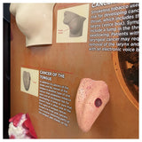 Smokeless Tobacco Consequences 3-D Display-Teaching Aids-Birth Supplies Canada