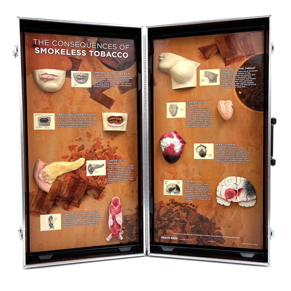 Smokeless Tobacco Consequences 3-D Display-Teaching Aids-Birth Supplies Canada