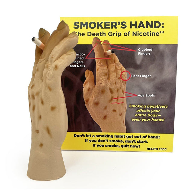 Smoker’s Hand: The Death Grip of Nicotine™ | Healthcare Training Model - Buy Medical Supplies Online Canada