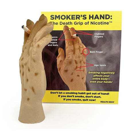 Smoker’s Hand: The Death Grip of Nicotine™ | Healthcare Training Model - Buy Medical Supplies Online Canada