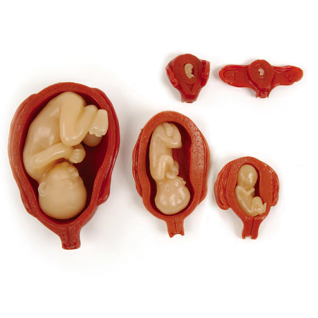 Uterus/Fetus Model Set (5) | Healthcare Training Model - Buy Medical Supplies Online Canada