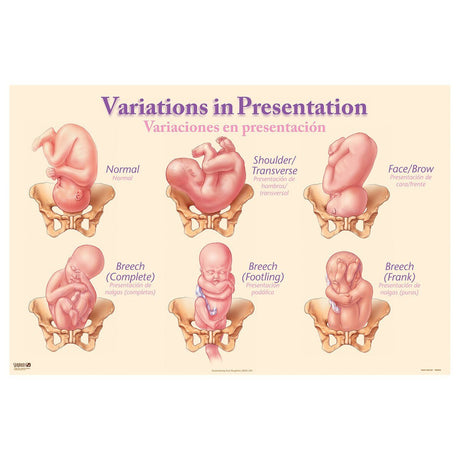 Variations in Presentation Chart | Healthcare Training Model - Buy Medical Supplies Online Canada