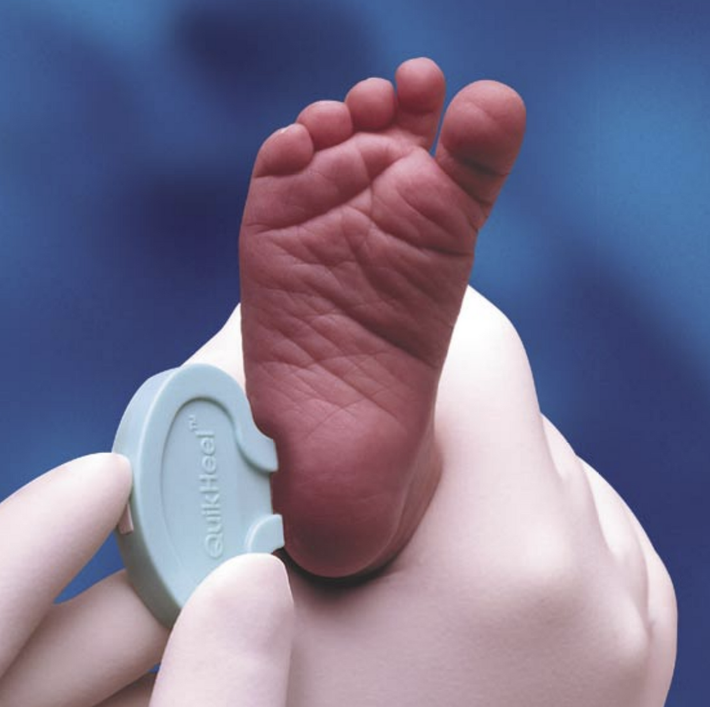 The heel prick test can help early detection and diagnosis of diseases in  newborns - Diag
